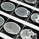 Teleradiologia – jak działa i dlaczego coraz częściej zastępuje tradycyjne opisy badań?