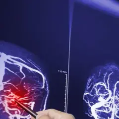 Jak odróżnić nerwicę od guza mózgu - objawy, które musisz znać