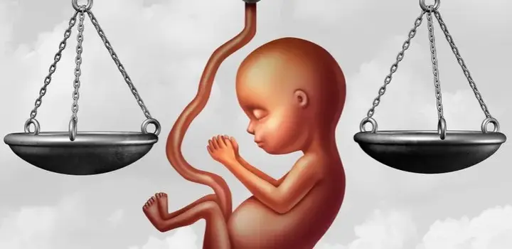 Zespół Downa a aborcja: co warto wiedzieć o przepisach w Polsce