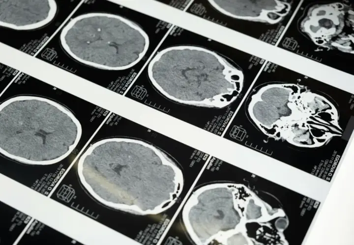 Teleradiologia – jak działa i dlaczego coraz częściej zastępuje tradycyjne opisy badań?