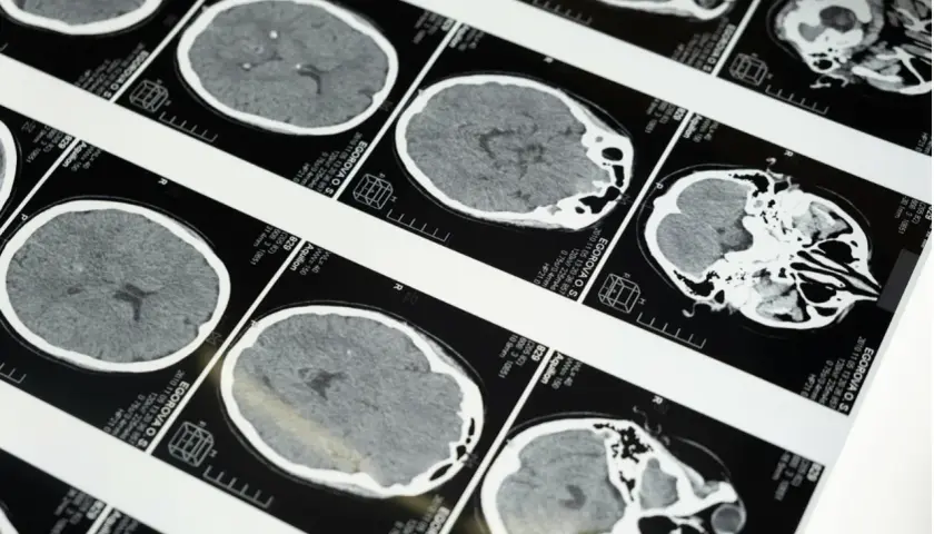 Teleradiologia – jak działa i dlaczego coraz częściej zastępuje tradycyjne opisy badań?