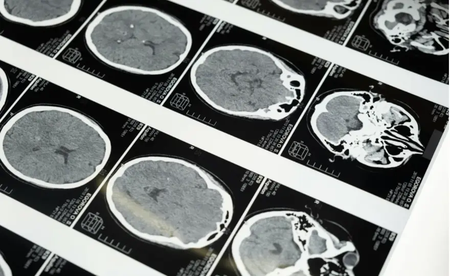 Teleradiologia – jak działa i dlaczego coraz częściej zastępuje tradycyjne opisy badań?